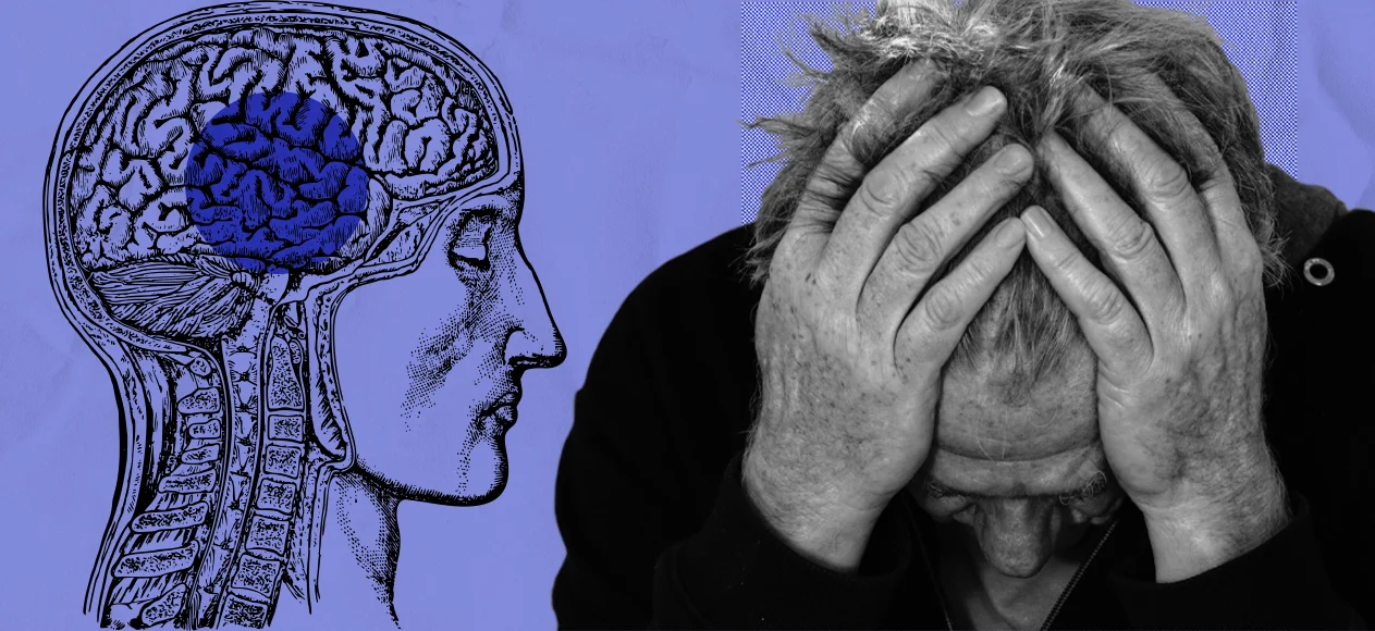 Ишемический инсульт