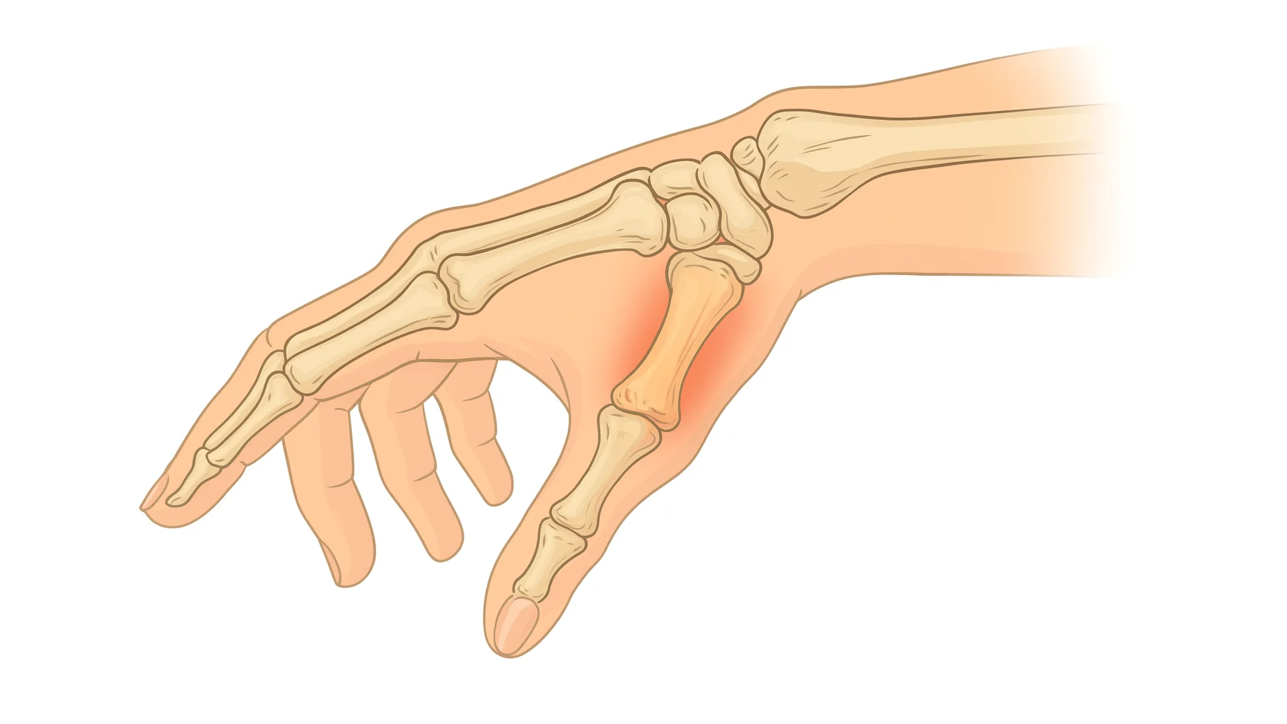 Болит сустав большого пальца на руке