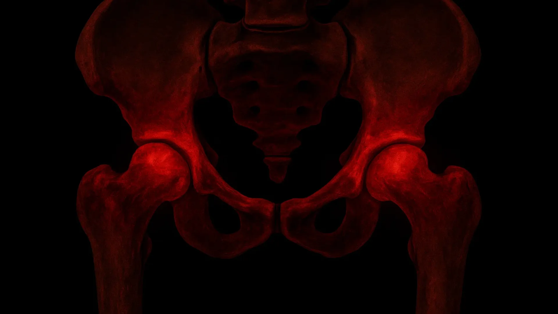 Вывих бедра