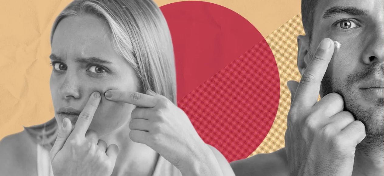 Фурункул - симптомы и лечение