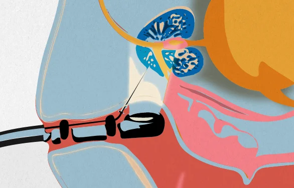 диагностика простатита