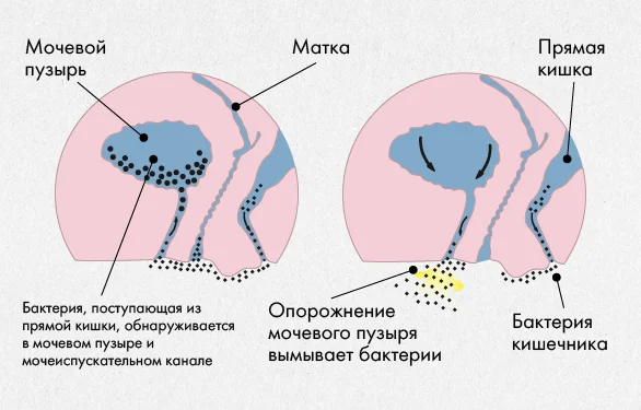 мочеполовая система у женщин