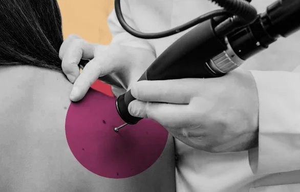 3lechenie furunkula.webp 3lechenie furunkula.webp