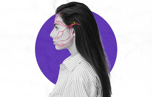 На картинке выделены зоны проявления мигрени