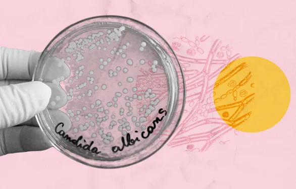 чашка петри