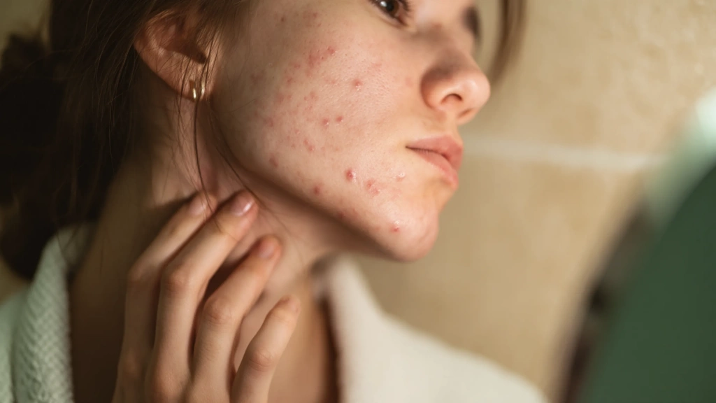 сыпь на шее - 3_3.webp сыпь на шее - 3_3.webp